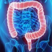 Enfermedades intestinales incurables por la gastroenterologia